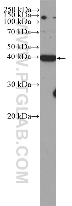 CDK5R2/p39 Rabbit anti-Human, Mouse, Rat, Polyclonal, Proteintech:Antibodies:Primary