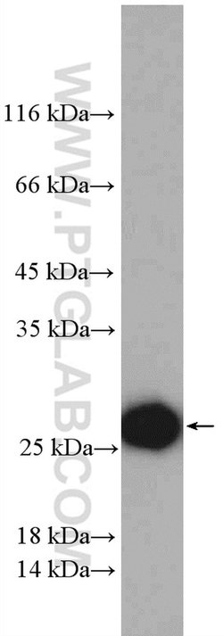 ISOC2 Rabbit anti-Human, Mouse, Polyclonal, Proteintech 150 &mu;L; Unconjugated:Antibodies,