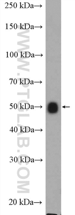 ALG11 Rabbit anti-Human, Mouse, Rat, Polyclonal, Proteintech:Antibodies:Primary