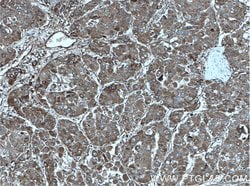 ITGAV Rabbit anti-Human, Polyclonal, Proteintech 150 &mu;L; Unconjugated:Antibodies,