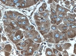 ITGAV Rabbit anti-Human, Polyclonal, Proteintech 150 &mu;L; Unconjugated:Antibodies,