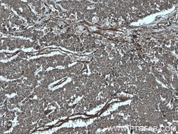 ITGAV Rabbit anti-Human, Polyclonal, Proteintech 150 &mu;L; Unconjugated:Antibodies,
