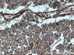 ITGAV Rabbit anti-Human, Polyclonal, Proteintech 150 &mu;L; Unconjugated:Antibodies,