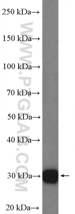 CCDC124 Rabbit anti-Human, Mouse, Polyclonal, Proteintech