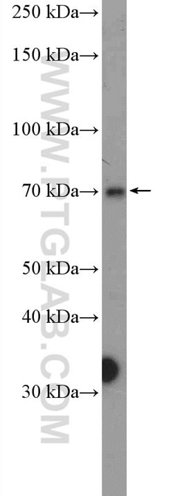 PRMT5 Rabbit anti-Human, Polyclonal, Proteintech 150 &mu;L | Buy Online | Proteintech Group Inc | Fisher Scientific