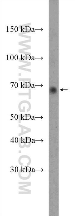 PRMT5 Rabbit anti-Human, Polyclonal, Proteintech 150 &mu;L | Buy Online | Proteintech Group Inc | Fisher Scientific