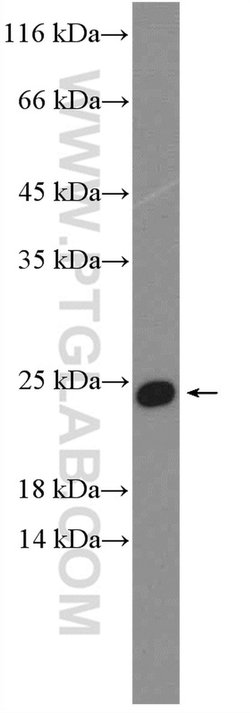 C17orf49 Rabbit anti-Human, Mouse, Polyclonal, Proteintech 150 &mu;L; Unconjugated:Antibodies,