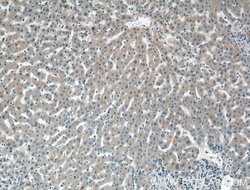 C2 Rabbit anti-Human, Polyclonal, Proteintech 150 &mu;L; Unconjugated:Antibodies,