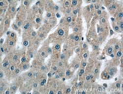 C2 Rabbit anti-Human, Polyclonal, Proteintech 150 &mu;L; Unconjugated:Antibodies,