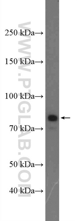 C2 Rabbit anti-Human, Polyclonal, Proteintech 150 &mu;L; Unconjugated:Antibodies,