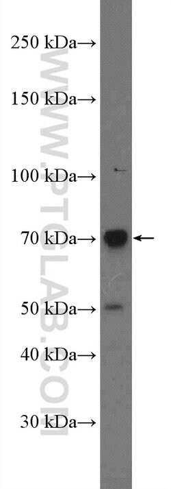 C2 Rabbit anti-Human, Polyclonal, Proteintech 150 &mu;L; Unconjugated:Antibodies,