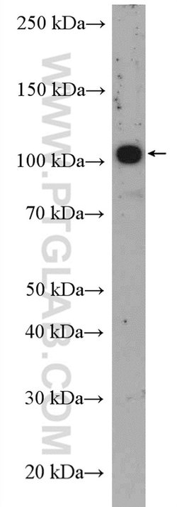 ST14 Rabbit anti-Human, Polyclonal, Proteintech 20 &mu;L; Unconjugated:Antibodies,