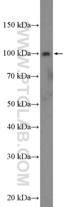 ST14 Rabbit anti-Human, Polyclonal, Proteintech 20 &mu;L; Unconjugated:Antibodies,
