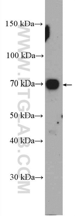 ZDHHC8 Rabbit anti-Human, Mouse, Polyclonal, Proteintech 20 &mu;L; Unconjugated:Antibodies,