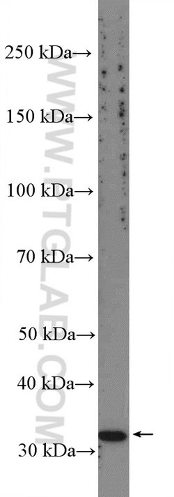 CCDC92 Rabbit anti-Human, Mouse, Rat, Polyclonal, Proteintech