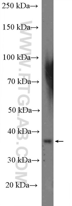 CCDC92 Rabbit anti-Human, Mouse, Rat, Polyclonal, Proteintech:Anticorps:Anticorps