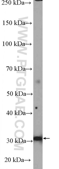 CCDC92 Rabbit anti-Human, Mouse, Rat, Polyclonal, Proteintech:Anticorps:Anticorps