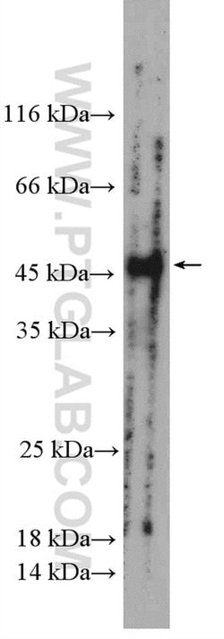 LMBRD1 Rabbit anti-Human, Mouse, Polyclonal, Proteintech 150 &mu;L; Unconjugated:Antibodies,