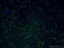 Huntingtin Rabbit anti-Human, Mouse, Polyclonal, Proteintech:Anticuerpos:Anticuerpos