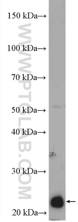 RAB5C Rabbit anti-Human, Polyclonal, Proteintech 20 &mu;L; Unconjugated:Antibodies,