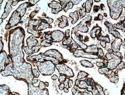 ITGA5 Rabbit anti-Human, Polyclonal, Proteintech:Antibodies:Primary Antibodies