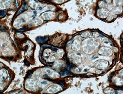 ITGA5 Rabbit anti-Human, Polyclonal, Proteintech:Antibodies:Primary Antibodies