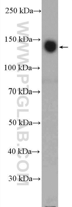 ITGA5 Rabbit anti-Human, Polyclonal, Proteintech:Antibodies:Primary Antibodies