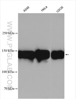 ITGA5 Rabbit anti-Human, Polyclonal, Proteintech:Antibodies:Primary Antibodies
