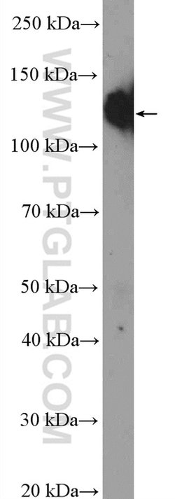ITGA5 Rabbit anti-Human, Polyclonal, Proteintech:Antibodies:Primary Antibodies