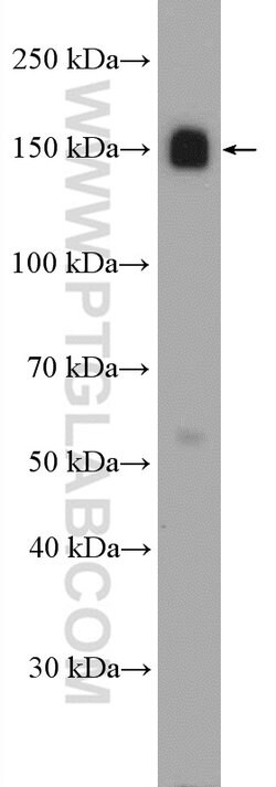 ITGA5 Rabbit anti-Human, Polyclonal, Proteintech:Antibodies:Primary Antibodies