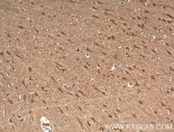 CACNA1E Rabbit anti-Human, Mouse, Polyclonal, Proteintech 150 &mu;L; Unconjugated:Antibodies,