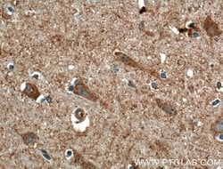 CACNA1E Rabbit anti-Human, Mouse, Polyclonal, Proteintech 150 &mu;L; Unconjugated:Antibodies,
