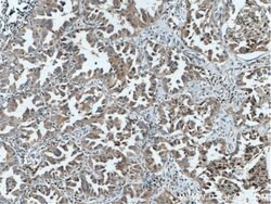 RICTOR Rabbit anti-Human, Mouse, Polyclonal, Proteintech 150 &mu;L; Unconjugated:Antibodies,