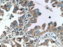 RICTOR Rabbit anti-Human, Mouse, Polyclonal, Proteintech 150 &mu;L; Unconjugated:Antibodies,