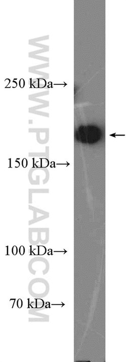 RICTOR Rabbit anti-Human, Mouse, Polyclonal, Proteintech 150 &mu;L; Unconjugated:Antibodies,