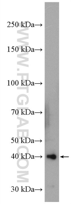 GNAQ Rabbit anti-Human, Mouse, Polyclonal, Proteintech 150 &mu;L | Buy Online | Proteintech Group Inc | Fisher Scientific