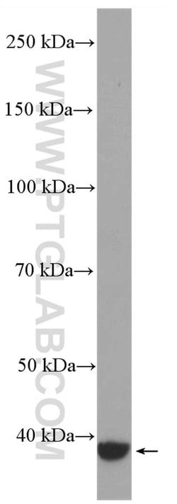 GNAQ Rabbit anti-Human, Mouse, Polyclonal, Proteintech 150 &mu;L | Buy Online | Proteintech Group Inc | Fisher Scientific