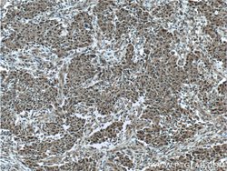 KMT2D Rabbit anti-Human, Polyclonal, Proteintech 150 &mu;L; Unconjugated:Antibodies,