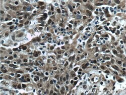 KMT2D Rabbit anti-Human, Polyclonal, Proteintech 150 &mu;L; Unconjugated:Antibodies,