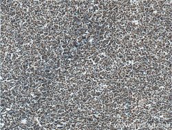 KMT2D Rabbit anti-Human, Polyclonal, Proteintech 150 &mu;L; Unconjugated:Antibodies,