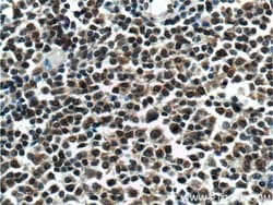 KMT2D Rabbit anti-Human, Polyclonal, Proteintech 150 &mu;L; Unconjugated:Antibodies,