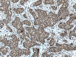KMT2D Rabbit anti-Human, Polyclonal, Proteintech 150 &mu;L; Unconjugated:Antibodies,