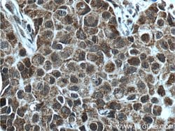 KMT2D Rabbit anti-Human, Polyclonal, Proteintech 150 &mu;L; Unconjugated:Antibodies,