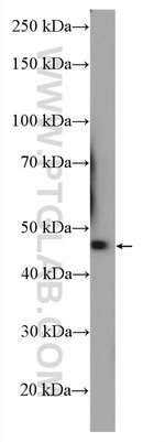 Thumbnail_KLHDC1 Rabbit anti-Human, Mouse, Rat, Polyclonal, Proteintech 20 &mu;L;