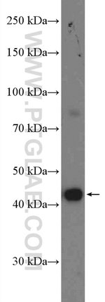 Thumbnail_KLHDC1 Rabbit anti-Human, Mouse, Rat, Polyclonal, Proteintech 20 &mu;L;