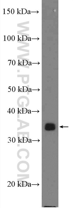 KCTD10 Rabbit anti-Human, Polyclonal, Proteintech:Antibodies:Primary Antibodies