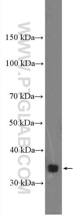 KCTD10 Rabbit anti-Human, Polyclonal, Proteintech:Antibodies:Primary Antibodies