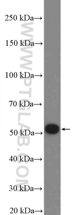 FBXO31 Rabbit anti-Human, Mouse, Polyclonal, Proteintech:Antibodies:Primary