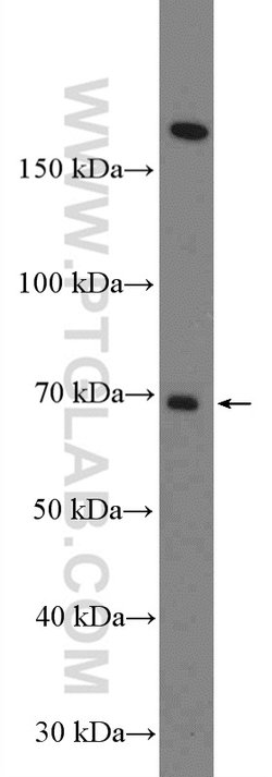 FBXO31 Rabbit anti-Human, Mouse, Polyclonal, Proteintech:Antibodies:Primary