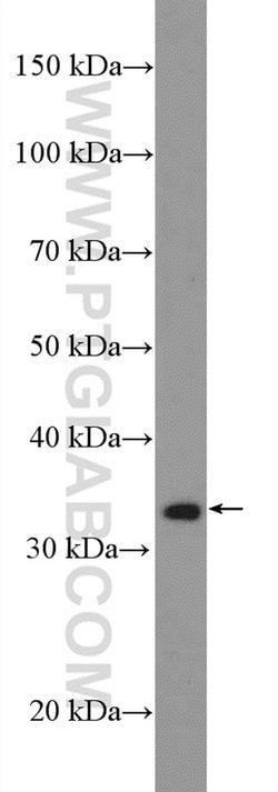 DUSP2 Rabbit anti-Human, Mouse, Polyclonal, Proteintech 20 &mu;L; Unconjugated:Antibodies,